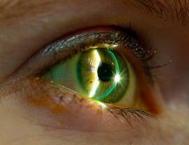 Win a free consultation at our Dry Eye Clinic